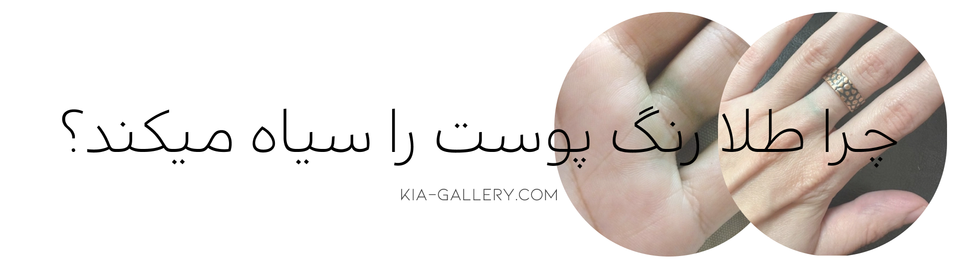 آیا طلا پوست را سیاه می کند؟ سیاه شدن رنگ پوست با طلا
